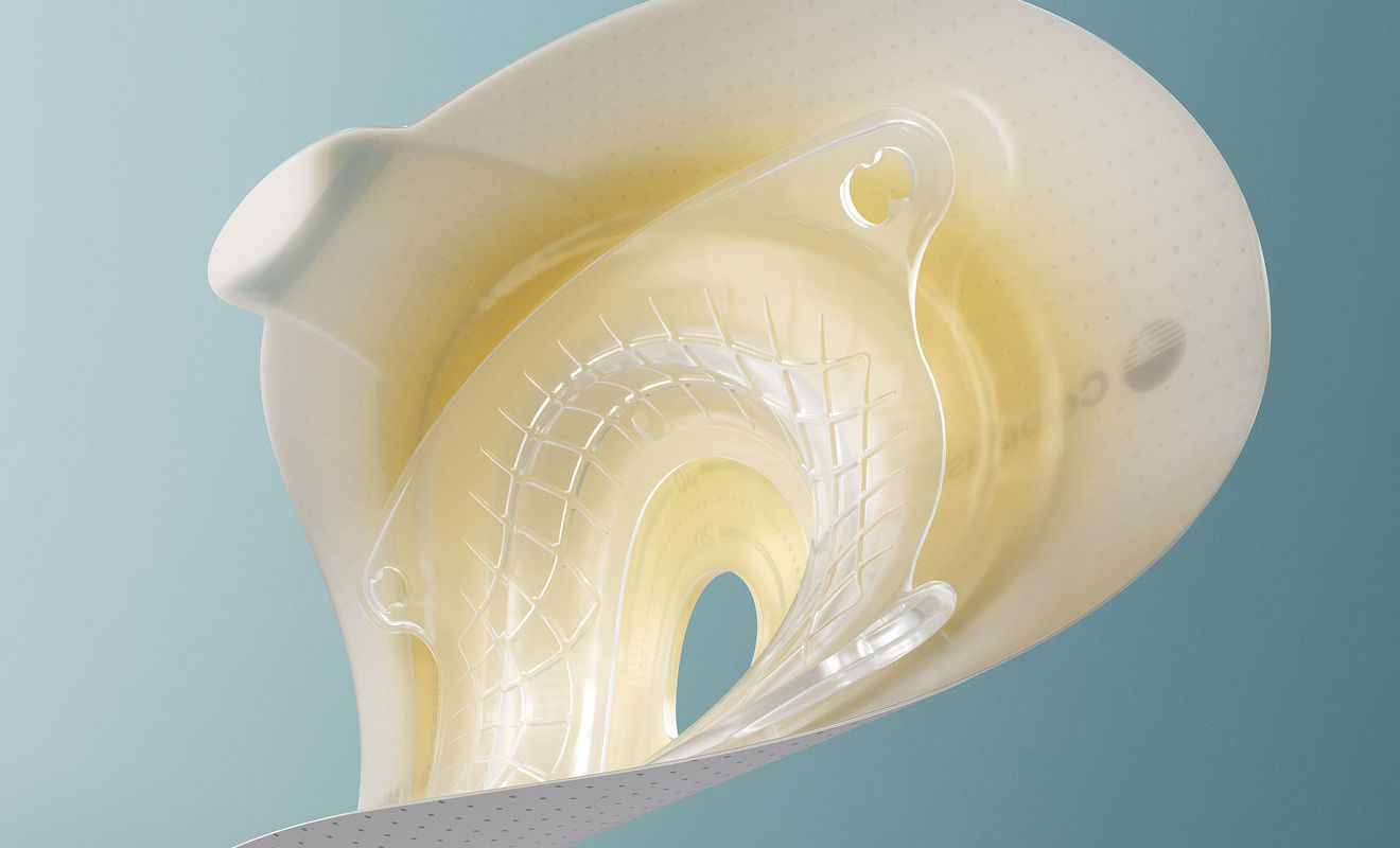 Perché le soluzioni convesse sono necessarie